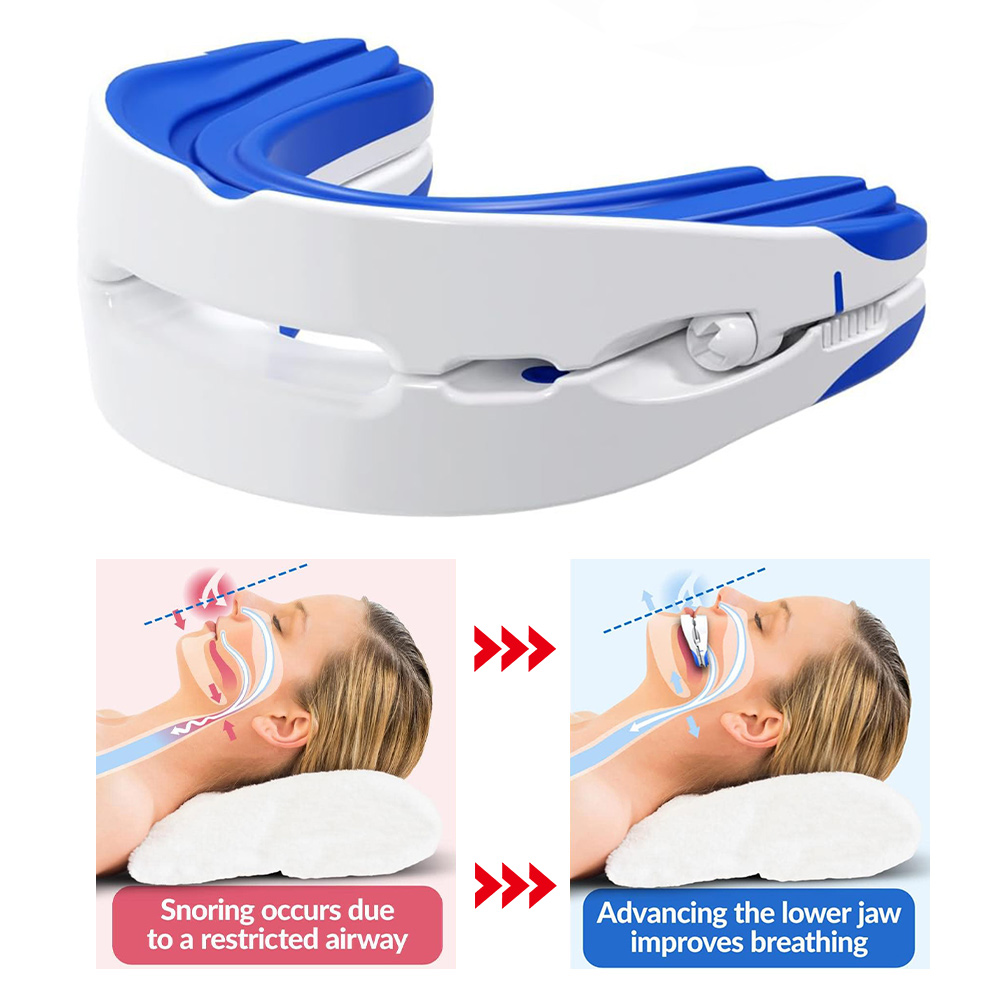 iKeener Adjustable Anti-Snoring Mouth Guard, Anti-Snoring Device, Prevents Teeth Grinding During Sleep and Improves Men Sleep Quality ราคา 970 บาท*ส่งฟรี