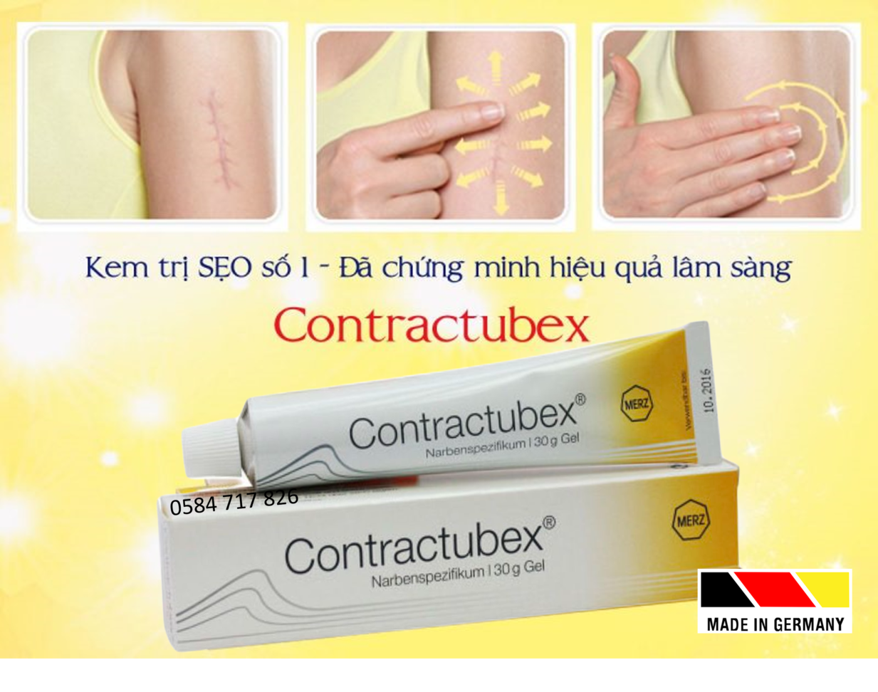 Kem làm mờ sẹo lồi, sẹo phì đại Contractubex 30g, Đức