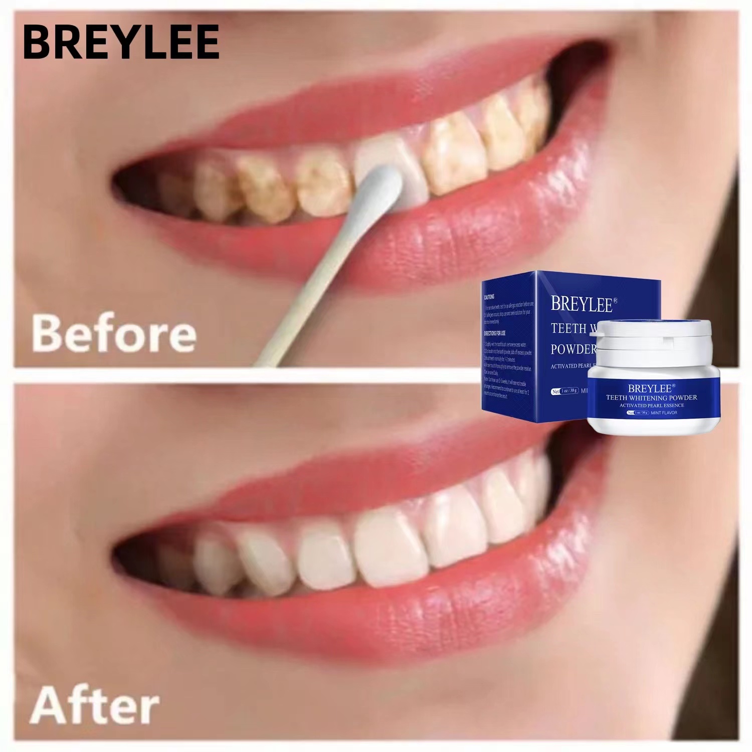 BREYLEE Bột Tẩy Trắng Răng Kem Đánh Răng Nha Khoa Dụng Cụ Răng Trắng Sạch