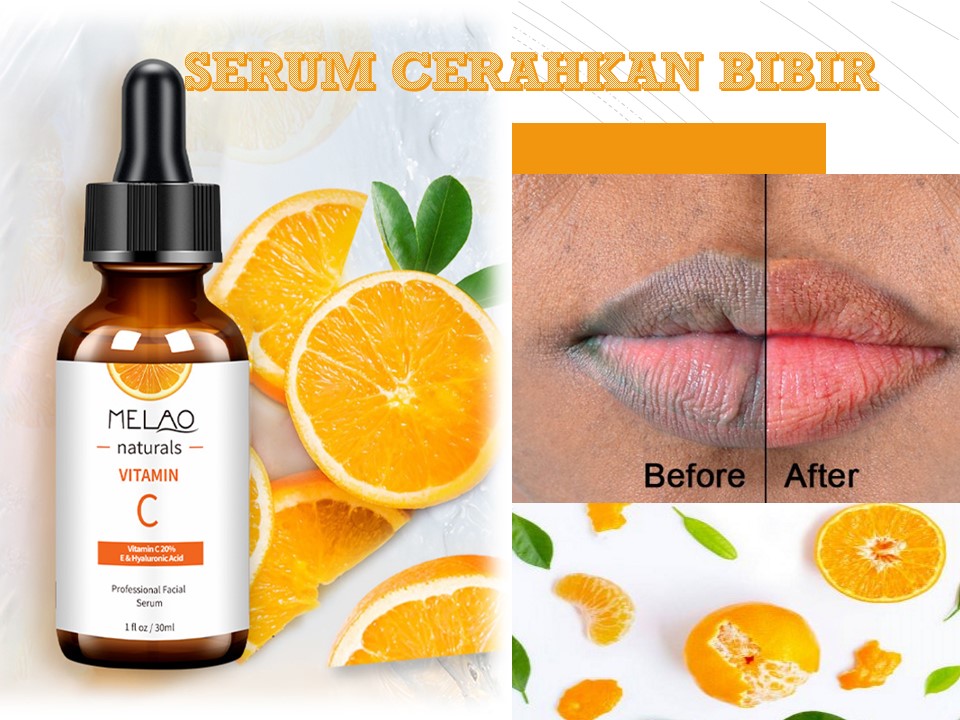 Vitamin serum melao lips c for Melao Naturals