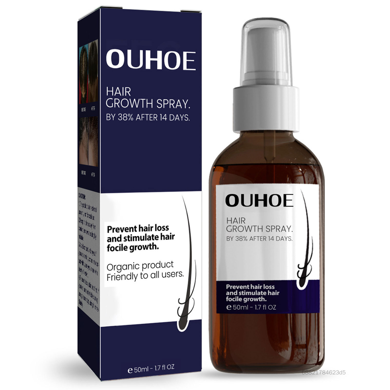 Tăng trưởng tóc Ngăn ngừa mất cân bằng bình xịt Microbiota Bảo vệ Sức khỏe Sức khỏe Da da cho nam giới chăm sóc tóc mong manh DBS-VN