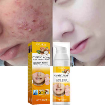 Kem chấm mụn hiệu quả hết mụn siêu tốc ngừa sẹo thâm dành cho da dầu nhờn,Kem giảm mụn chuyên sâu /30ml