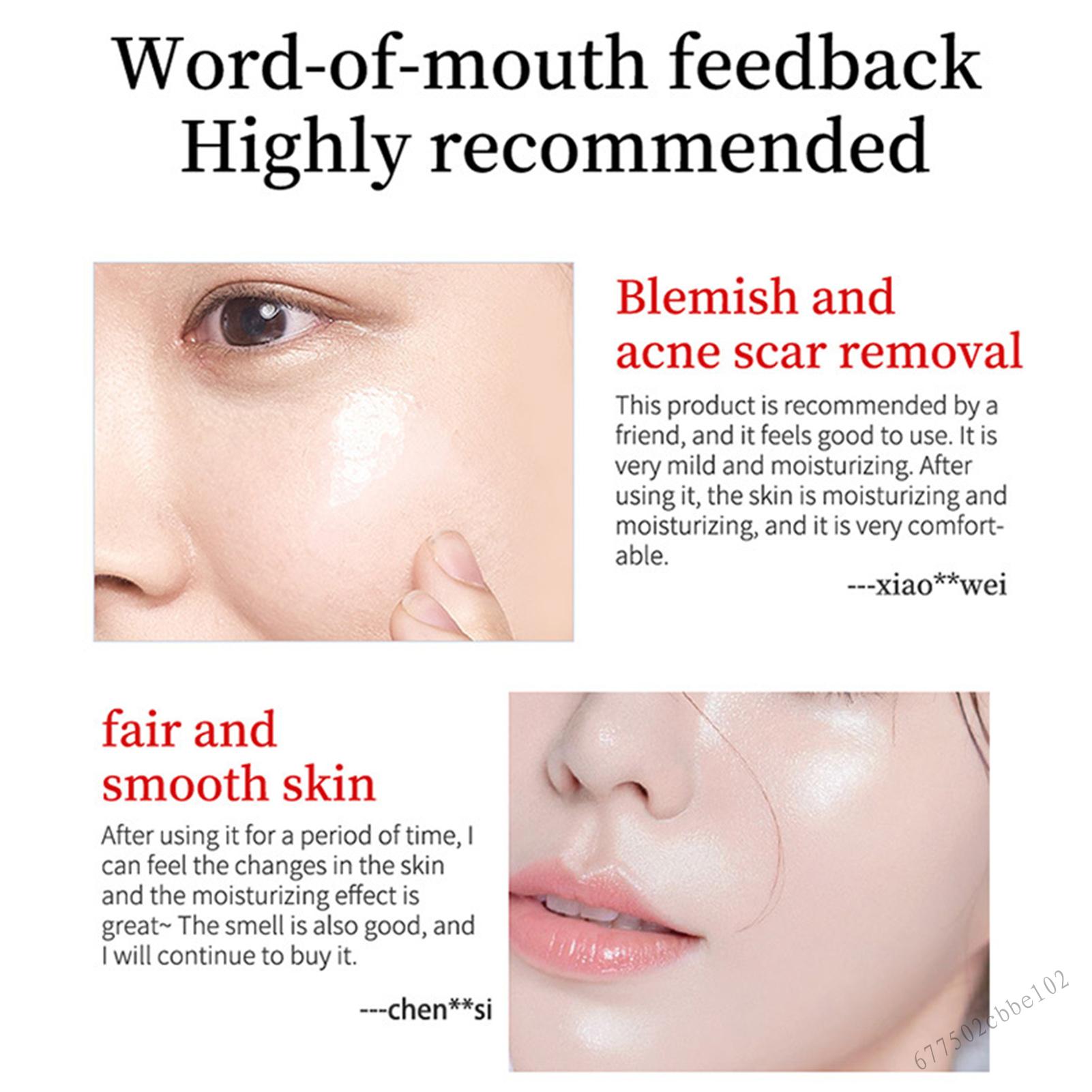 Whitening Spot Removal Cream Freckle Cream Nourishing Skin Care Cream for Pore Refining Resurfacing 