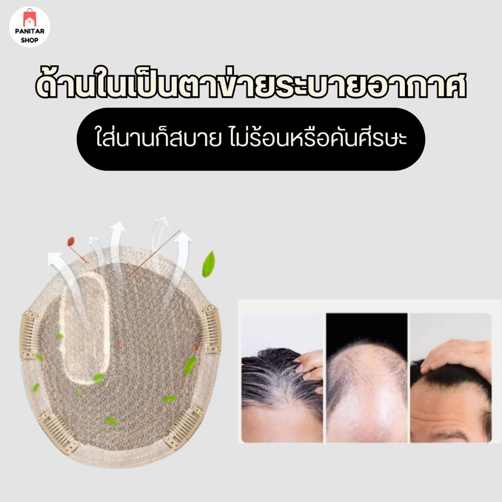 วิกผมชายแสกข้าง ใส่แล้วดูดี เพิ่มความมั่นใจปิดผมบางหรือศีรษะล้านได้แนบเนียน 7