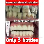 100g kem đánh răng bằng miệng răng trắng sửa chữa kem đánh răng fluoride cho hơi thở mới TF-Ais-VN