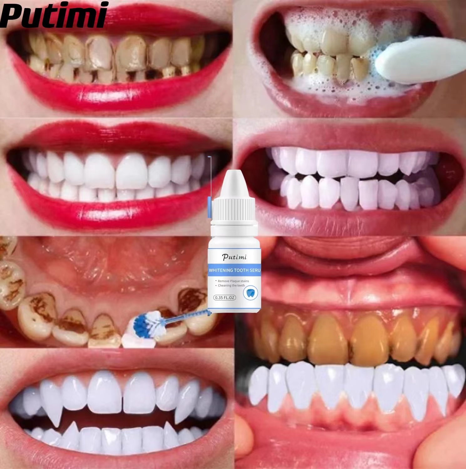 PUTIMI TRẮNG RĂNG Teeth Clean Spot Cleaning LÀM SẠCH RĂNG Teeth Whitening