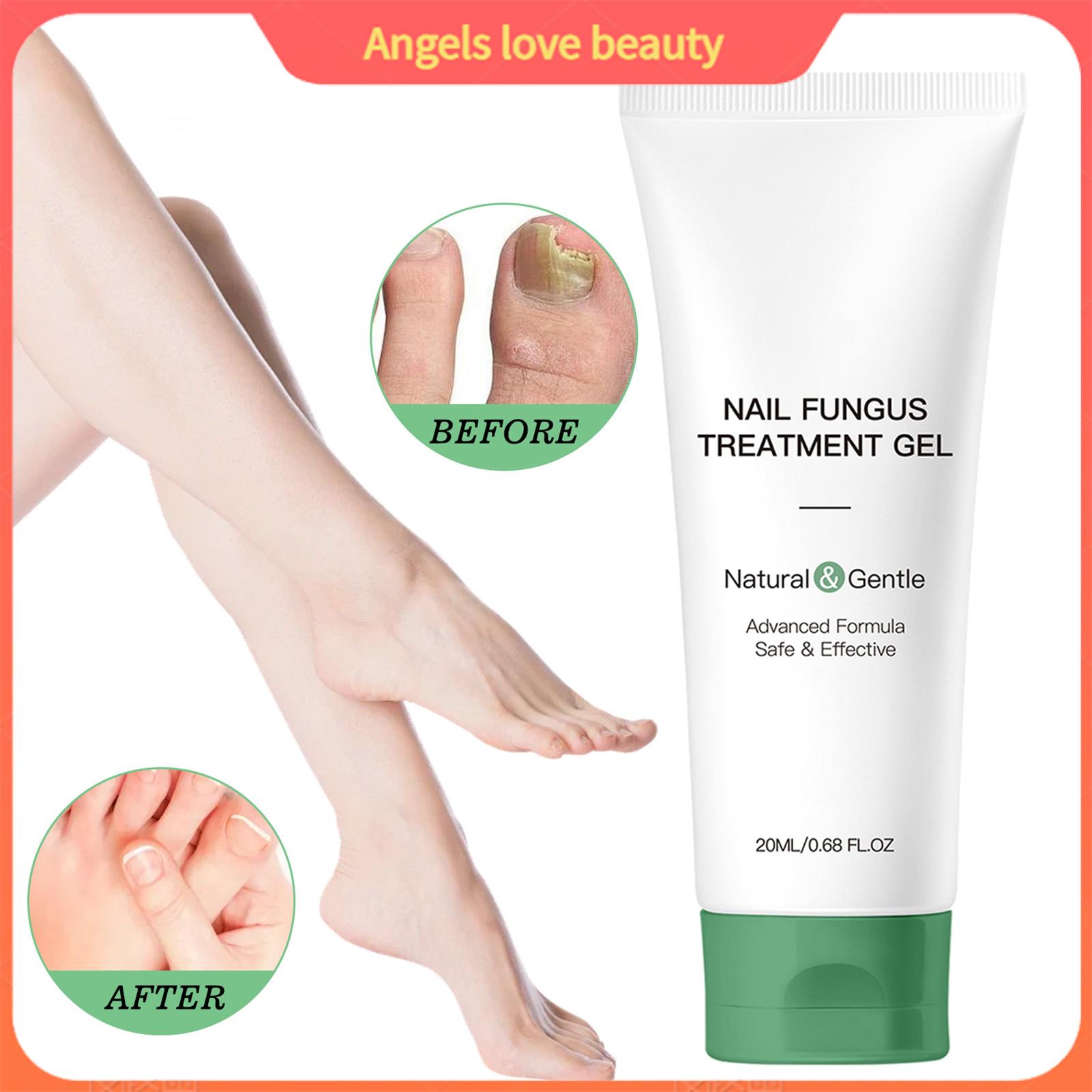 Nail Repair Gel Women Nail Repair Gel 20ml Nail Fungus Treatment Gel Natural Ingredients for Men and Women Hydrating Moisturizing Nail Repair Care Gel