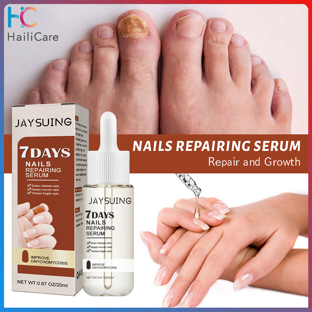 Hailicare dầu trị nấm móng tay dụng cụ sửa chữa thủ công tinh chất gel loại bỏ nấm móng ngón chân Kem chống nhiễm trùng nấm loại bỏ móng tay 20ml