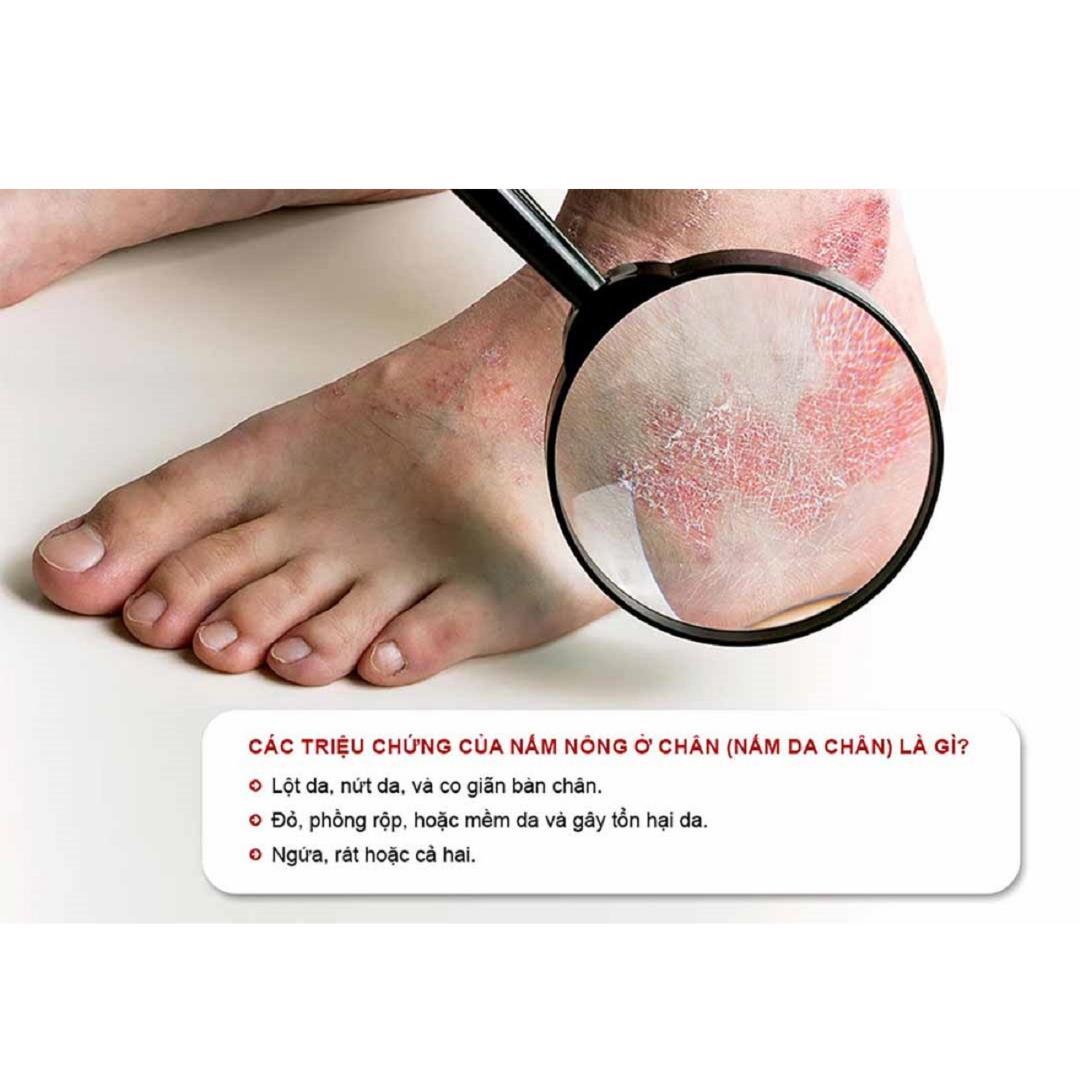 COD[BÁN CHẠY SỐ 1] Xịt Kháng Khuẩn Khử Mùi Hôi Chân Dùng Cho Cả Nam Và Nữ Loại Bỏ Nấm Làm Lành Các Vết Nứt Nẻ Chân Tay Thần Tốc Chống Lại Vi Khuẩn Nấm Ngưng Ra Mồ Hôi Chân Tay Ngăn Mùi