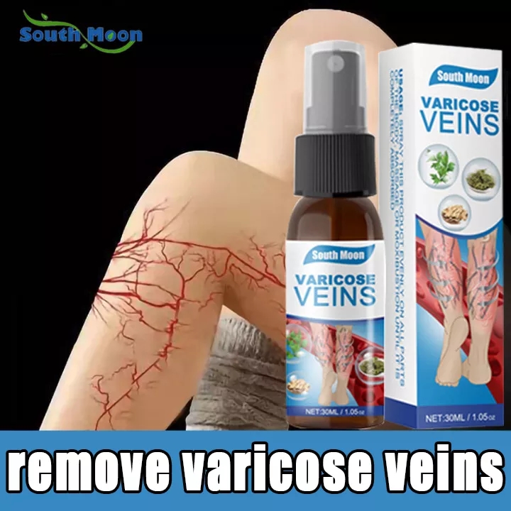 Xit bôi suy giãn tĩnh mạch hiệu quả nội địa Trung,giúp lưu thông tĩnh mạch phục hồi hiệu quả các mạch máu bị sưng ở tay và chân giảm đau Suy tĩnh mạch Sửa chữa chỗ gân xanh ở chân giun đất/30ML