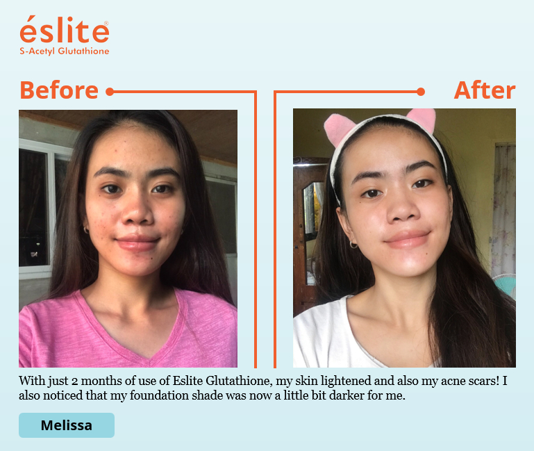 Eslite S-Acetyl Glutathione 1 Bottle (Official Distributor)
