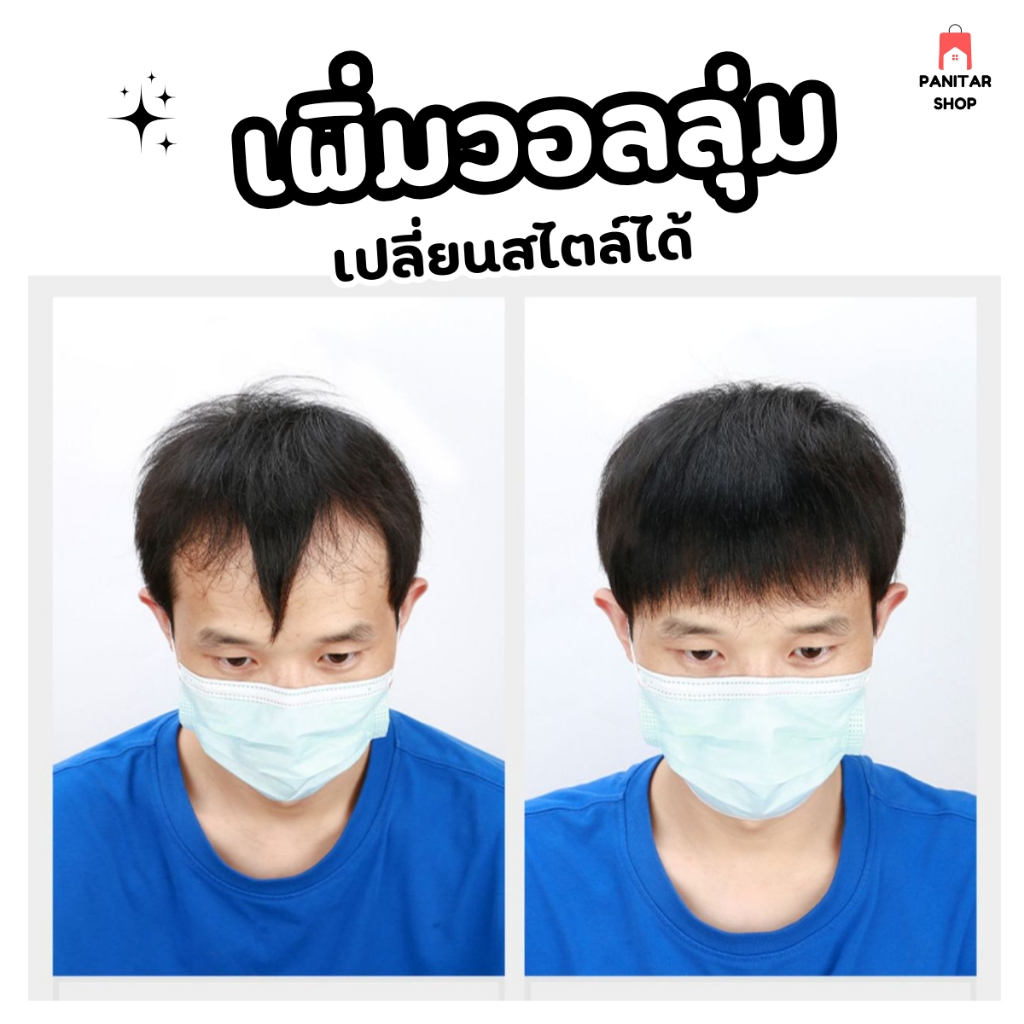 เสริมผมหนาหน้าม้าผู้ชายผมแท้ ช่วยเพิ่มวอลลุ่ม เปลี่ยนสไตล์ได้ ใส่สบาย ไม่คัน ไม่ระคายเคือง 4