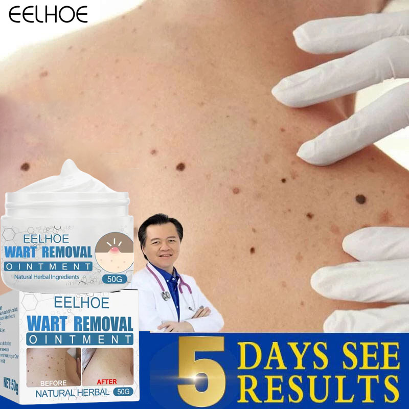 Kem thảo dược hỗ trợ tẩy mụn cóc, mụn thịt, mụn lưng, mụt ruồi, thành phần thảo dược tự nhiên