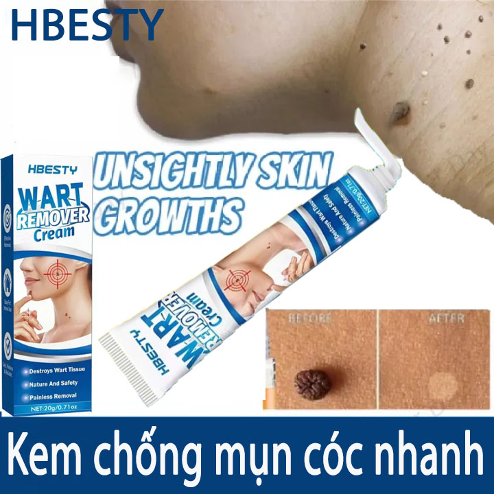Loại bỏ mụn ruồi trâu,mụn thịt,mụn cóc,mụn cơm cứng đầu nhanh chóng ,lấy lại làn da tự tin căng đẹp.