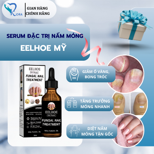 Serum Đánh Tan Nấm Móng Tay Chân EELHOE Mỹ - Loại Bỏ Bong Tróc Ố Vàng, Diệt Nấm Móng Tận Gốc, Tăng Trưởng Móng Nhanh