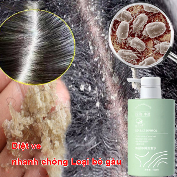 Loại bỏ gàu diệt ve sảng khoái kiềm dầu dầu gội đầu muối biển 500ml nhẹ nhàng cải thiện tóc xoăn cứng tóc tơ dầu gội loại bỏ gàu chống ngứa giá rẻ