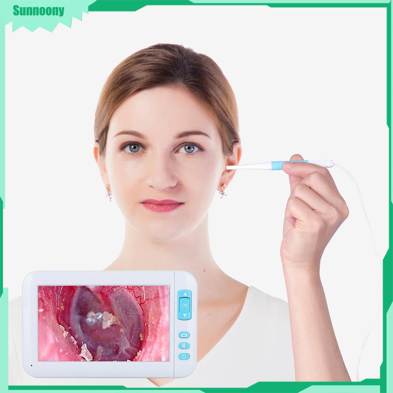 Sunnoony 4.3" Inch Display Ear Pick Endoscope Otoscope 6 LED for Adult Children Giá 750,161 Đồng*Miễn phí vận chuyển
