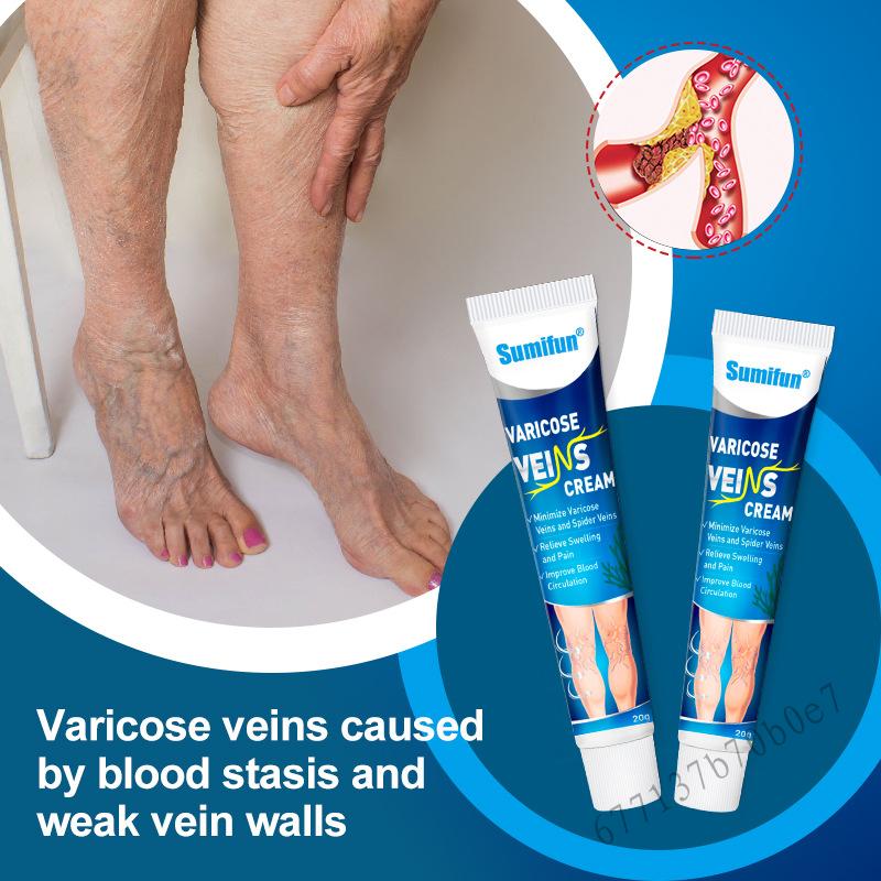 Varicose Veins Cream, Effective Clinicals Vein Care Cream Skin Professional Earthworm Leg Treatment 