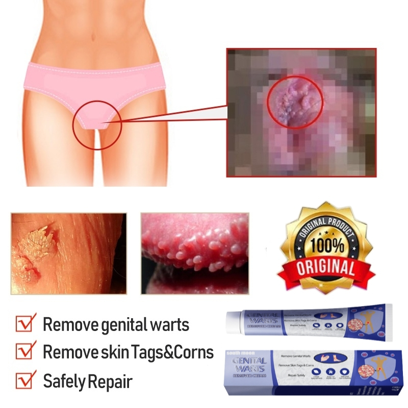 Yalangoch ukrainalik ayol