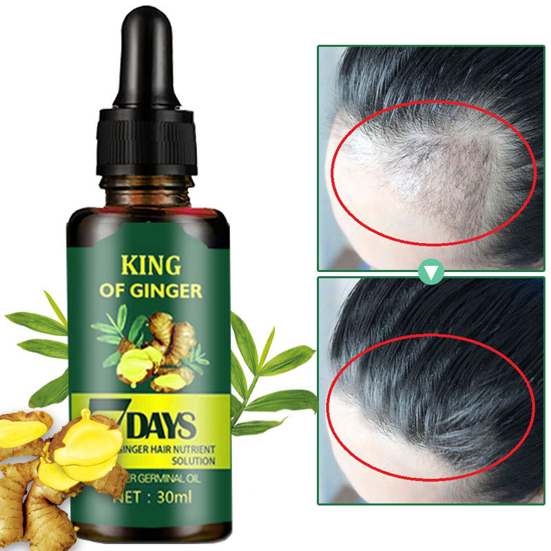 Serum mọc tóc Tinh chất dưỡng tóc Tinh Chất Chống Rụng Tóc 30ml kích thích mọc tóc nhanh làm dày giúp giảm rụng tóc giải