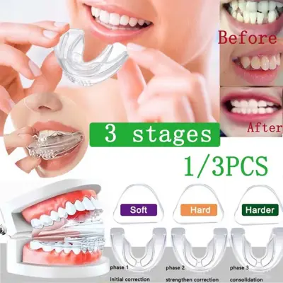 SDCWWCF Professional Mouthguard Brace TPU Dentista Material Teeth Corrector Invisible Teeth Brace Set Night Molar Correct Retainer Tooth Orthodontic Appliance Alignment Braces ​for Tooth