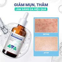 Serum hỗ trợ cải thiện mụn làm dịu dưỡng da Trioderma ActiBalance+ 30ml