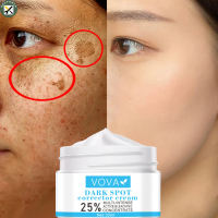 BouPower Whitening Freckle Cream Remove Melasma Acne Spot Pigment Melanin Dark Spots Pigmentation Moisturizing Gel Skin Care
