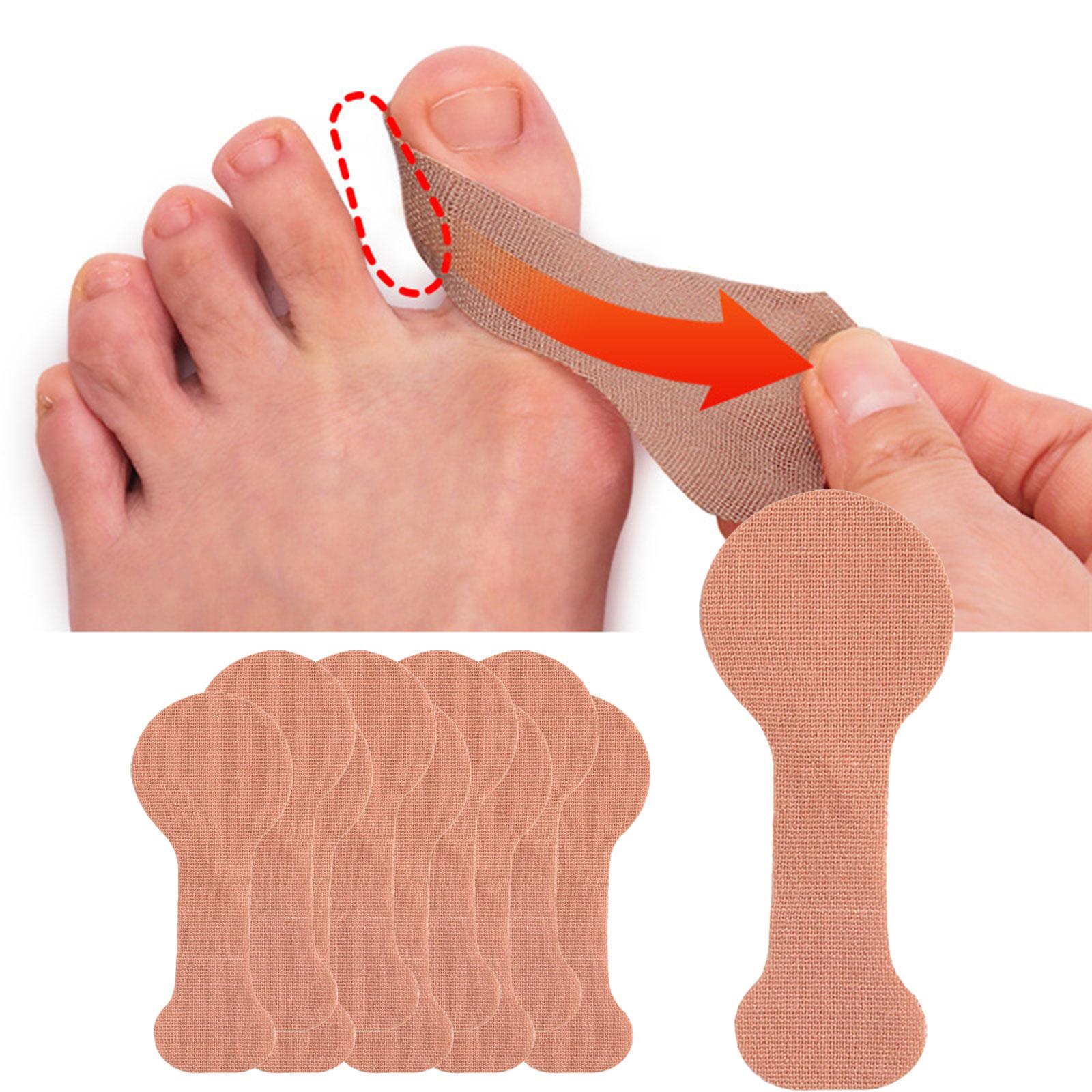 Miracle Shining 10Pcs Big Toe Corrector Easy to Use Adjuster Hallux High Elastic Cloth ราคา 81 บาท*ส่งฟรี