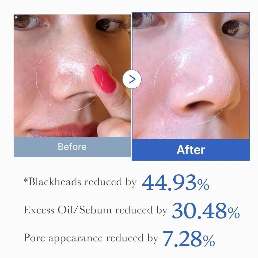 Medicube Zero Pore Pads 2.0 70 pads