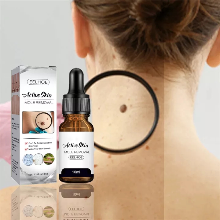 [HCM]MOLE REMOVAL Tẩy nốt ruồi xóa mụn ruồi tại nhà an toàn hiệu quả nhập khẩu Nga và gel mờ sẹo Kem ngăn sẹo nga kem ngừa sẹo lồi thâm sẹo rỗ lâu năm các loại sẹo mụn miếng dán mụn cóc hột mụn cơm - 10ML