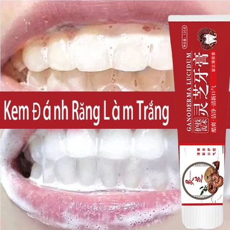 Kem đánh trắng răng kem đánh răng kem trắng răng 120g trắng răng kem đánh răng tẩy cao răng làm trắng răng ố vàng