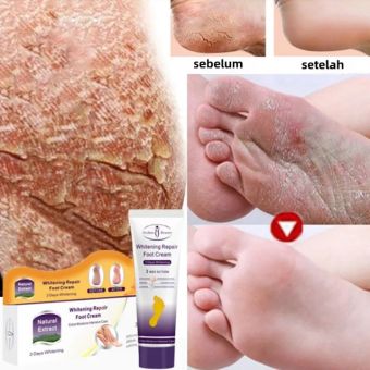 Whitening repair foot cream Kem giảm nứt nẻ gót chân tay,Kem dưỡng và ngừa nứt nẻ da ngừa nứt gót chân tay, dưỡng ẩm da tay, ngừa thâm mông, khuỷu tay, đầu gối/Foot care100ML