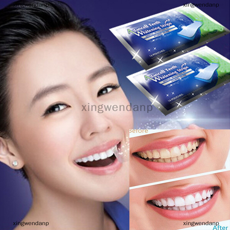 Xingwendanp 2 sản phẩm tẩy trắng chăm sóc răng miệng chuyên nghiệp tẩy trắng vết lõm