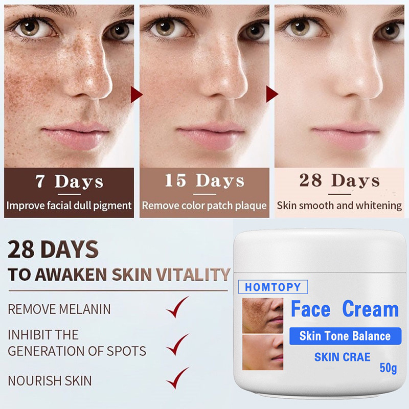 Fade Facial Spot Cream Melasma Spots Moisture Replenishment Skin Care Cream Skin Whitening Spot Crea