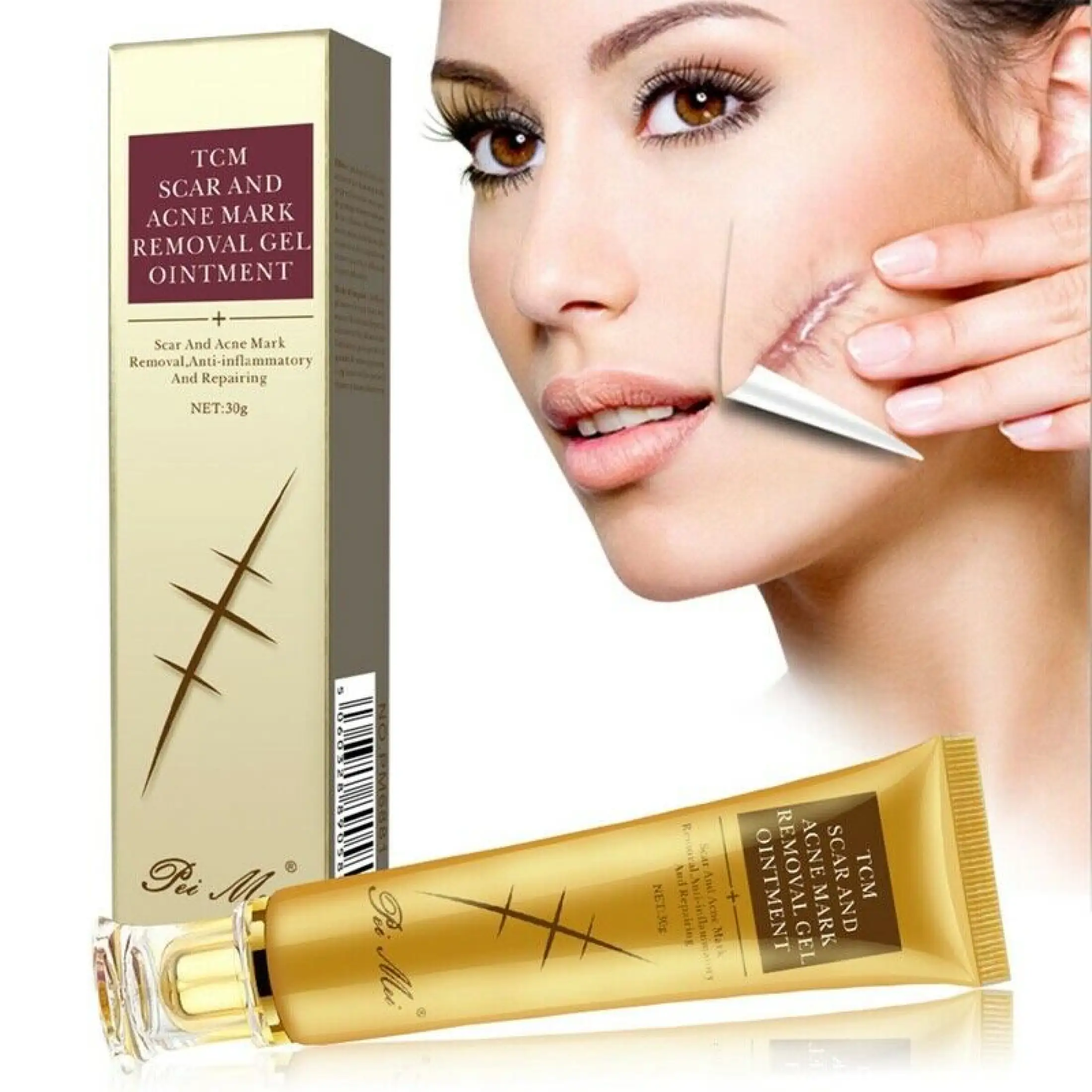 tcm acne scar removal cream price