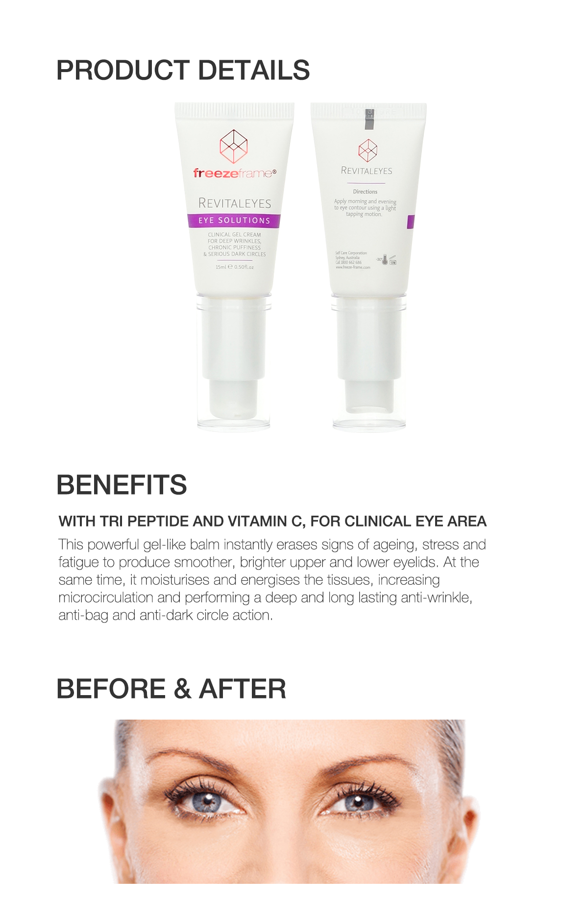 dark circles under eyes cream chemist warehouse